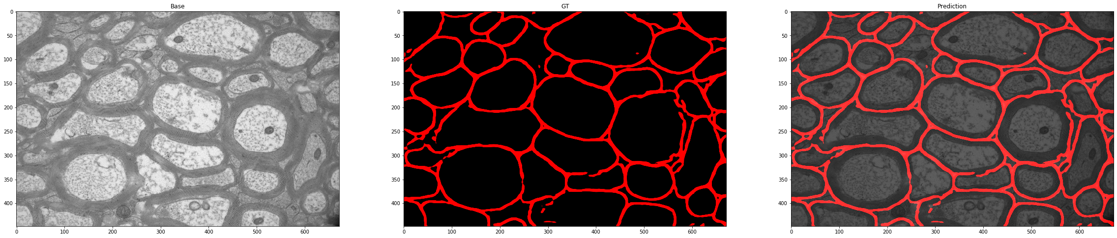 projects.myelin_title